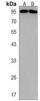 ARHGAP27 Rabbit Polyclonal Antibody