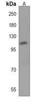 HIPK1 Rabbit Polyclonal Antibody