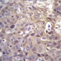 HIPK1 Rabbit Polyclonal Antibody