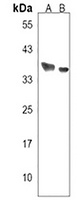 PPP1R42 Rabbit Polyclonal Antibody