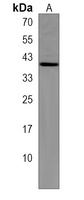 CHMP6 Rabbit Polyclonal Antibody