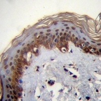 RBM42 Rabbit Polyclonal Antibody