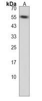 FBXO15 Rabbit Polyclonal Antibody
