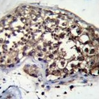 FBXO15 Rabbit Polyclonal Antibody
