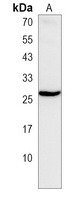 CRYBA1 Rabbit Polyclonal Antibody