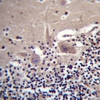 CRYBA1 Rabbit Polyclonal Antibody