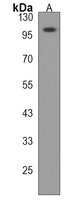 ESPNL Rabbit Polyclonal Antibody