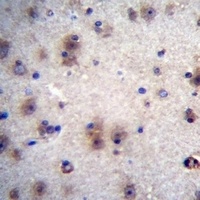 EVPLL Rabbit Polyclonal Antibody