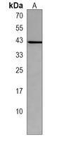 PAR3 Rabbit Polyclonal Antibody