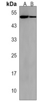 PRMT8 Rabbit Polyclonal Antibody