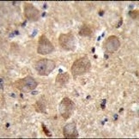 PCDHAC2 Rabbit Polyclonal Antibody