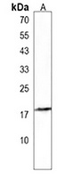 MBD3L3 Rabbit Polyclonal Antibody