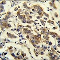 MBD3L3 Rabbit Polyclonal Antibody