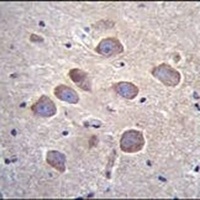 PCDHA8 Rabbit Polyclonal Antibody