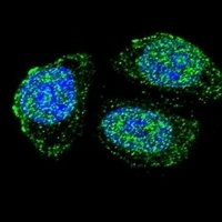 IL-17B Antibody