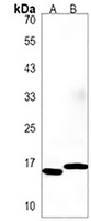 EIF5AL1 Rabbit Polyclonal Antibody