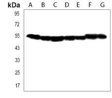 TUBB2B Rabbit Polyclonal Antibody
