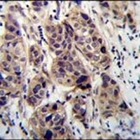 DCAF8L2 Rabbit Polyclonal Antibody