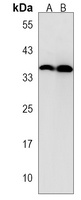 GPM6B Rabbit Polyclonal Antibody