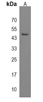 TBC1D13 Rabbit Polyclonal Antibody
