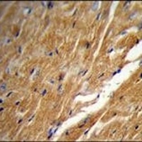 TBC1D13 Rabbit Polyclonal Antibody