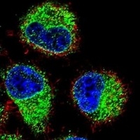 TBC1D13 Rabbit Polyclonal Antibody