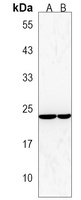 FRAT2 Rabbit Polyclonal Antibody