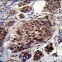 FRAT2 Rabbit Polyclonal Antibody