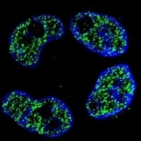 FRAT2 Rabbit Polyclonal Antibody