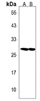 SPATS1 Rabbit Polyclonal Antibody