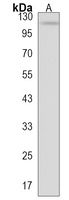 DIEXF Rabbit Polyclonal Antibody