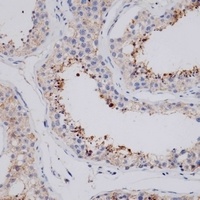 VSIG8 Rabbit Polyclonal Antibody