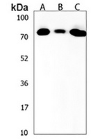 ZNF860 Rabbit Polyclonal Antibody