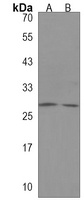 LCN9 Rabbit Polyclonal Antibody