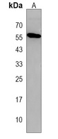 SMTNL2 Rabbit Polyclonal Antibody