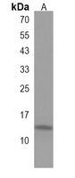 HCFC1R1 Rabbit Polyclonal Antibody
