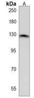 DDX60L Rabbit Polyclonal Antibody