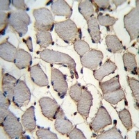 DDX60L Rabbit Polyclonal Antibody