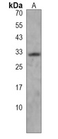 DTWD1 Rabbit Polyclonal Antibody