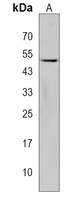 NUDT19 Rabbit Polyclonal Antibody