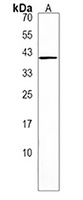 FADS6 Rabbit Polyclonal Antibody
