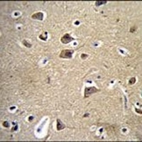 FADS6 Rabbit Polyclonal Antibody