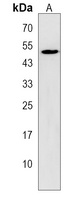 ZNF829 Rabbit Polyclonal Antibody