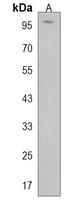 FAM160B1 Rabbit Polyclonal Antibody
