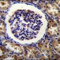 FAM160B1 Rabbit Polyclonal Antibody