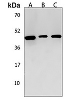 ANKRD40 Rabbit Polyclonal Antibody
