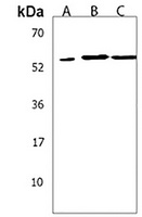 PIP5KL1 Rabbit Polyclonal Antibody