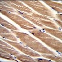 PIP5KL1 Rabbit Polyclonal Antibody
