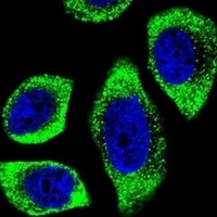 PIP5KL1 Rabbit Polyclonal Antibody