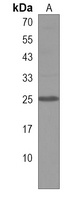 FAM96A Rabbit Polyclonal Antibody